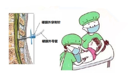 e427857a7aff3514b187ecdeee4bfcc0.png